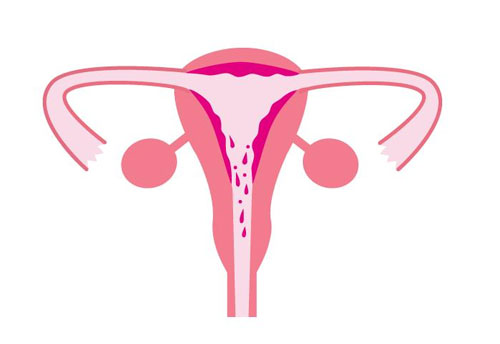 多囊卵巢应该注意什么？饮食调理是非常重要的！