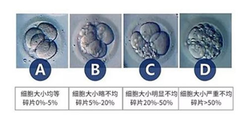 试管胚胎级别怎么区分？按照胚胎质量的好坏来分的！