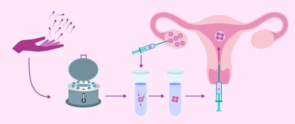 早期囊胚移植能成吗？囊胚移植成功率高吗？
