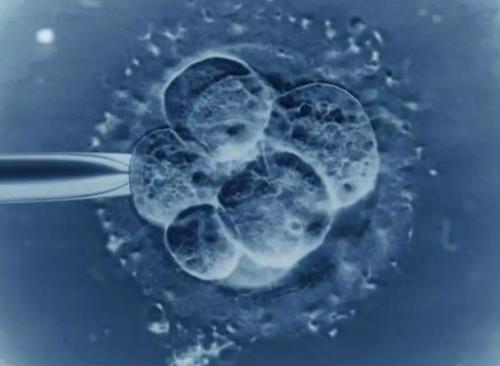 移植鲜胚五天了什么感觉都没有正常吗？什么是鲜胚移植？
