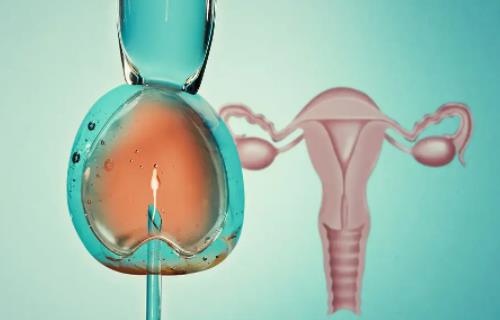 卵巢包块影响试管吗？患卵巢囊生包块能做试管吗？