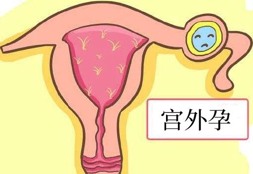 试管婴儿怎么会宫外孕？做试管婴儿会在发生宫外孕吗？