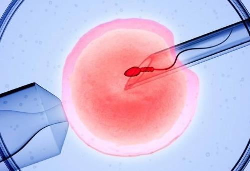 试管胚胎排出后会出血吗?试管婴儿移植后出血的原因是什么?